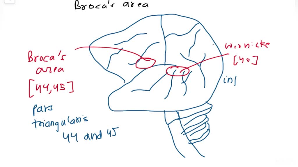 SOLVED Broca's area and Wernicke's area are extremely important for