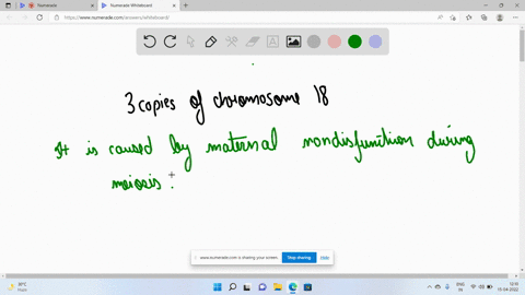 individuals-who-have-edwards-syndrome-have-three-copies-of-chromosome-18-this-disorder-is-caused-by-group-of-answer-choices-anondisjunction-during-meiosis-binappropriate-entry-into-s-phase-c-00018