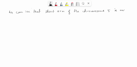 the-image-shown-below-is-a-karyotype-of-an-individual-who-has-a-chromosomal-disorder-called-cri-du-chat-syndrome-looking-carefully-at-chromosomes-5-what-is-the-best-term-for-the-alteration-t-10703