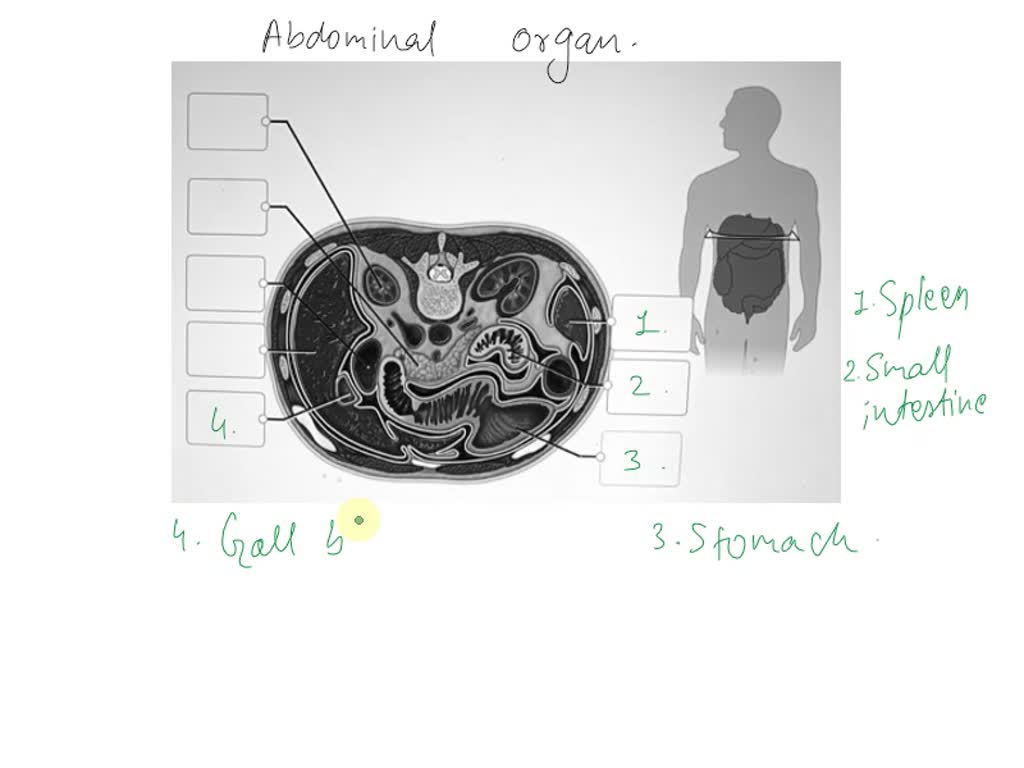 SOLVED: Label the various abdominal organs in the transverse section ...