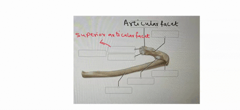 correctly-label-the-anatomical-features-of-the-rib-bones-11617