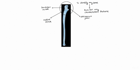 which-bone-is-in-this-image-30029