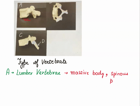 question-4-1-a-what-type-of-vertebrae-is-this-cervical-thoracic-or-lumbar-b-what-type-of-vertebrae-is-this-cervical-thoracic-or-lumbar-c-what-type-of-vertebrae-is-this-cervical-thoracic-or-l-54095