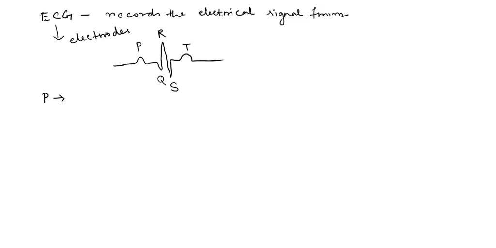 Interpret the components of a normal ECG pattern with a time scale by ...