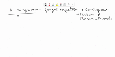 for-what-purpose-would-a-health-care-professional-use-a-woods-lamp-for-a-suspected-case-of-ringworm-32311