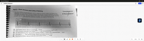 cardiophysiology-e-assignment-patient-16the-rhythm-shown-above-is-lacking-waves-17ekg-analysis-indicates-that-patient-is-are-not-contracting-19this-rate-is-the-normal-rangefaster-thanwithins-71942