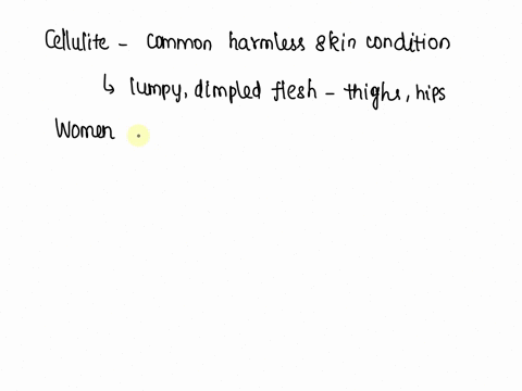 consider-each-statement-below-and-determine-which-is-correct-regarding-cellulite-in-the-body-view-available-hints-consider-each-statement-below-and-determine-which-is-correct-regarding-cellu-37412
