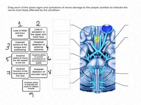 drag-each-of-the-given-signs-and-symptoms-of-nerve-damage-to-the-proper-position-to-indicate-the-nerve-most-likely-affected-by-the-condition-loss-of-loss-of-bitter-and-sour-taste-sensation-t-10949
