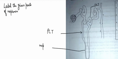 nephron-label-the-proximal-convoluted-tubulesedinent-the-flgurt-belov-diagram-of-descending-limbs-thick-and-thin-sersnents-convoluted-tubule-nephron-lcop-ascetidint-collecting-duct-then-add-76288