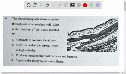 the-photomicrograph-shows-a-section-through-part-of-a-bronchus-wall-what-is-the-function-of-the-tissue-labelled-x-contracts-to-constrict-the-airway-b-helps-to-widen-the-airway-when-at-high-a-14065