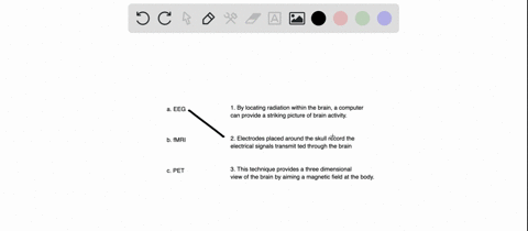 match-the-name-of-each-brain-scan-with-the-appropriate-description-a-eeg-b-mathrmfmri-c-pet-1-by-loc-86504