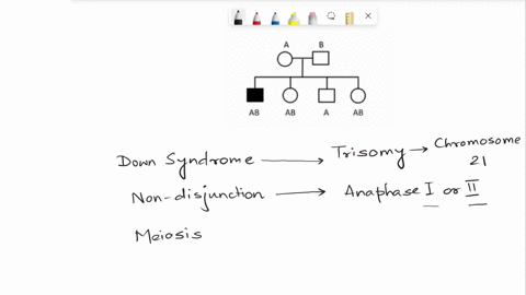 down-syndrome-is-caused-by-abnormalities-seen-individuals-with-3-copies-of-chromosome-2-individual-in-this-pedigree-has-down-syndrome-and-is-indicated-with-black-box-in-this-family-individua-31127