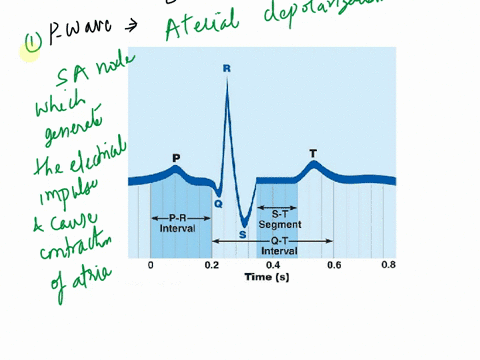 intervol-time-event-is-occurring-at-the-p-what-cardiac-cycle-what-event-is-occurring-during-the-qrs-complex-what-event-does-the-t-wave-represent-patient-who-has-suffered-a-myocardial-infarct-30417