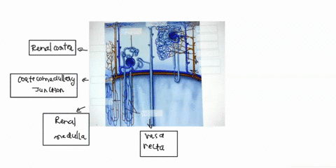 identify-the-renal-blood-vessels-and-structures-of-the-cortical-and-juxtamedullary-nephrons-by-clicking-and-dragging-the-labels-to-the-correct-location-cortical-nephror-afferent-arteriol-cor-14717
