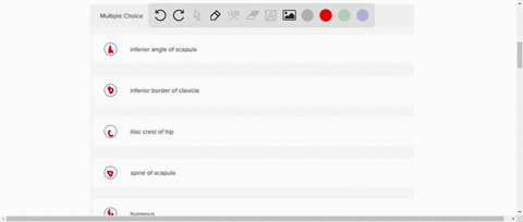 what-is-the-insertion-of-the-highlighted-muscle-35693