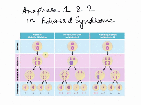 a-child-with-edwards-syndrome-has-the-karyotype-shown-children-born-with-this-disease-are-small-cogni-tively-impaired-and-die-as-infants-due-to-heart-failure-what-is-abnormal-about-the-karyo-70789