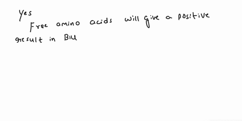 do-you-think-free-amino-acids-will-give-a-positive-result-in-biuret-test-why-or-why-not-98244
