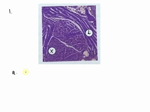 muscle-physiologyidentification-actions-lab-activity-3skeletal-muscle-histology-examine-the-image-of-skeletal-muscle-from-the-tongue-the-tongue-has-bundles-of-skeletal-muscle-that-run-in-thr-10699