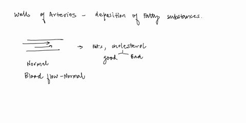 the-deposition-of-fatty-substance-in-the-lining-of-arteries-is-called-______-a-arteriosclerosis-b-atherosclerosis-c-angina-pectoris-d-angiology-47414