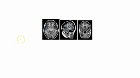 6-one-clinical-imaging-technique-that-is-used-to-visualize-the-brain-is-called-magnetic-resonance-imaging-mri-the-images-produced-by-this-technique-are-equivalent-to-looking-at-thin-slices-o-68825