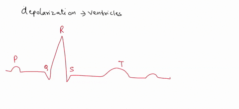 you-are-learning-to-read-electrocardiograms-you-know-that-the-patient-you-are-examining-has-a-pathology-affecting-the-depolarization-of-his-ventricles-therefore-youre-looking-for-a-change-in-30833