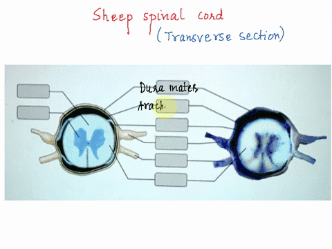 bellng-activity-shcep-spinal-cord-dissection-transverse-section-part-drag-the-labels-jporopnalo-ocaton-tno-inuro-srina-cord-durmatl-pulmaler-arachnod-mulal-dorg-amot-juncuor-ventiel-root-nhu-66135