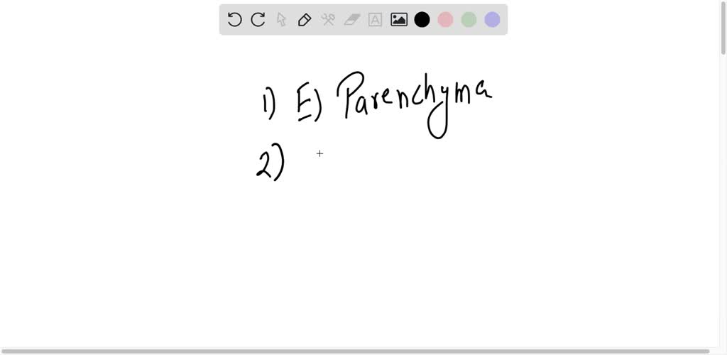 SOLVED Which of the following plant tissue and function is NOT matched