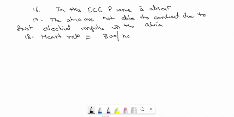 pleass-answer-16-20-part-2-short-answer-and-critical-thinking-cardio-physiology-e-assignment-telemetry-unit-are-often-in-critical-conaition-and-require-constant-monitoringincluding-vital-sig-62717