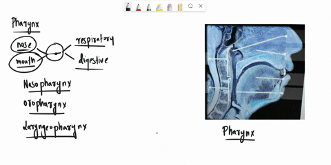 abel-the-structures-of-the-pharynx-based-on-the-hints-provided_-lingual-tonsil-pharyngeal-tonsil-nasal-septum-oropharynx-nasopharynx-retet-zoom-madbook-air-tongue-10339