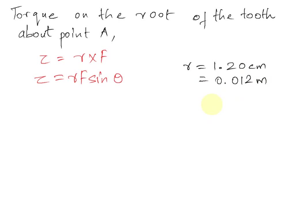 SOLVED A dental bracket exerts a horizontal force of 65.1 N on a tooth