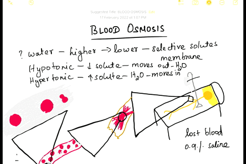 question-exercise-5-question-9-homework-unanswrered-patient-was-transported-to-clinic-for-treatment-following-motorcycle-accident-and-had-lost-abaut-pints-of-blocd-the-attending-nurse-provid-08281