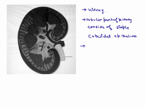 the-highlighted-structure-is-lined-by-what-type-of-epithelium-the-highlighted-structure-is-lined-by-what-type-of-epithellum-submit-requestanswer-21984