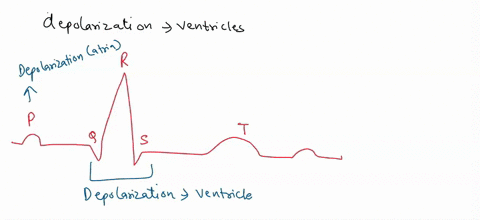 you-are-learning-to-read-electrocardiograms-you-know-that-the-patient-you-are-examining-has-a-pathology-affecting-the-depolarization-of-his-ventricles-therefore-youre-looking-for-a-change-in-30833