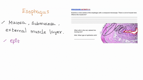 font-paragraph-d-styles-editing-cuiuvi-rectum-mcrqscqpy-proqcedurelaciiixll-examine-a-cross-section-of-the-esophagus-with-a-compound-microscope-there-is-a-lot-of-muscle-here_-what-is-this-mu-02667