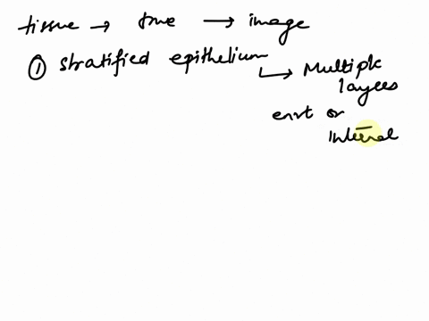 connect-janatomy-physiology-craclivc-drag-drop-qucstions-pool-questlon-ot-251-points-fy-the-iissue-type-shown-the-image-then-cilck-and-crg-each-iabel-into-the-apprcprate-calegayy-determi-tru-14142