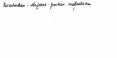inadequate-protein-intake-leads-to-kwashiorkor-the-subsequent-edema-is-most-closely-related-to-the-inadequate-synthesis-of-which-protein-a-gamma-globulin-b-glucagon-c-insulin-d-albumin-95592