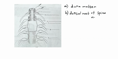 medical-135-spinal-cord-and-spinal-nerves-when-seen-in-cro-sectionthe-spin-arrangement-of-gray-matter-resenblinga-butffy-and-eernal-j-odpe-oegrayhorth-ethe-fien-fisnure-label-the-pares-of-rh-17708