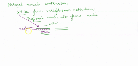 when-person-dics-muscles-become-rigid-and-fixed-in-position-condition-known-as-rigor-mortis-rigor-mortis-occurs-because-niuscle-cells-are-no-longer-supplied-wth-atp-also-calcium-flows-freely-46177