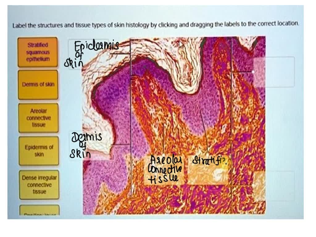 18. Label the structures and tissue types of skin histology by clicking ...