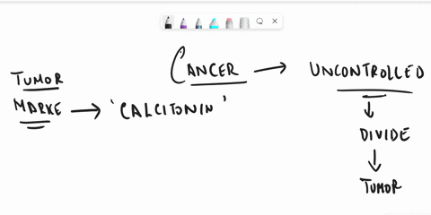 pick-one-which-of-the-following-is-the-hormonal-marker-for-thyroid-cancer-a-ca-125-b-human-chorionic-gonadotropin-c-calcitonin-d-carcinoembryonic-antigen-which-of-the-following-is-classified-37233