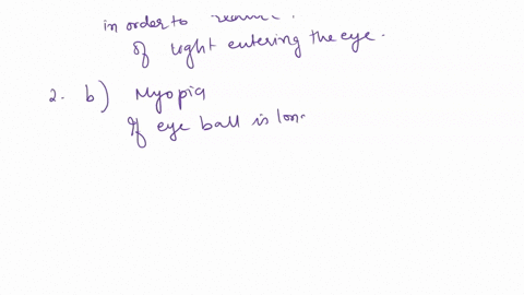 1a-sudden-rise-of-room-brightness-would-cause-group-of-answer-choices-acontraction-of-the-sphincter-pupillary-muscles-ba-decrease-in-the-size-of-the-pupil-cconversion-of-11-trans-to-11-cis-r-58162