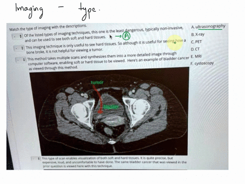 vquestioncor-question7-match-the-type-of-imaging-with-the-descriptions-aultrasonography-of-the-isted-types-of-imaging-technlquesthis-one-is-the-least-dangeroustypically-non-invasive-bx-ray-a-41072