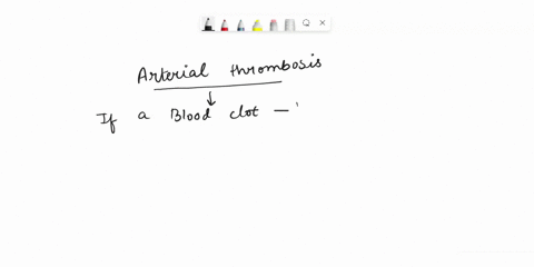 a-thrombus-can-clog-an-artery-what-occurs-when-an-artery-in-the-brain-is-blocked-answers-57528