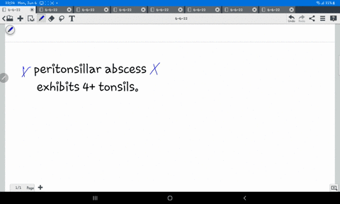 a-client-diagnosed-with-a-peritonsillar-abscess-exhibits-4-tonsils-and-is-not-able-to-eat-or-drink-what-is-the-nurses-priority-concern-for-this-client-28681
