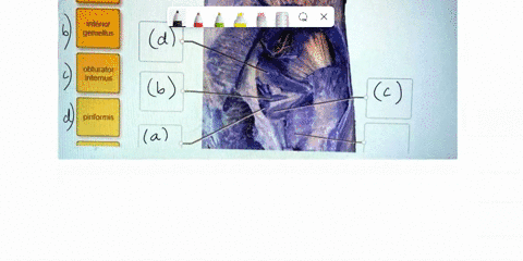 identify-the-muscles-that-laterally-rotate-the-thigh-quadratus-femoris-inferior-gemellus-obturator-internus-piriformis-97261
