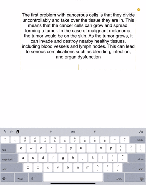 malignant-melanoma-you-are-learning-about-tissues-now-and-are-about-to-learn-about-skin-malignant-melanoma-is-a-type-of-cancer-that-can-originate-in-skin-many-cancers-are-based-in-epithelial-tissue-wh