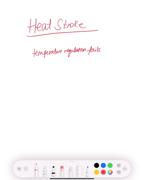 what-are-the-signs-and-symptoms-of-heat-stroke-select-all-that-apply-group-of-answer-choices-dizziness-slow-breathing-coma-slow-pulse-dry-skin