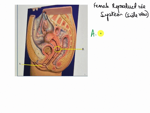 question4-in-the-image-belowthe-specific-region-of-the-organ-indicated-by-letter-a-is-the-a-03976