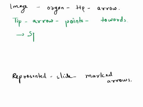 iwhat-organ-is-found-at-the-tipof-the-yellow-arrow-2the-slide-on-the-right-shows-tissue-from-this-organ-name-the-kind-of-structures-found-at-the-tips-of-the-red-arrows-13768