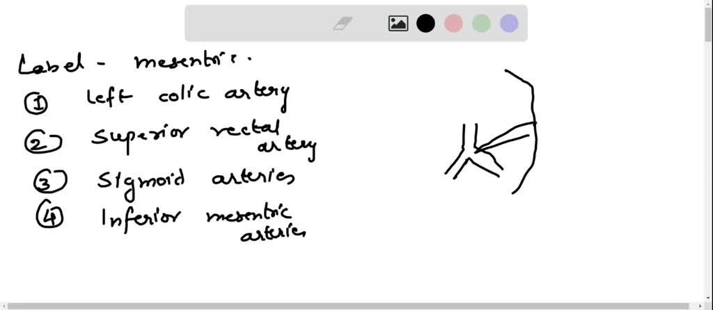 SOLVED: Correctly label the following veins of the abdomen and pelvic ...